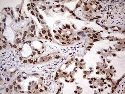 Immunohistochemistry: APPBP1 Antibody (OTI1E10) [NBP2-46087]