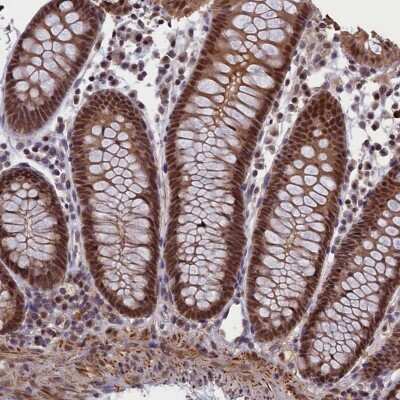 Immunohistochemistry-Paraffin: APPBP1 Antibody [NBP1-92162]