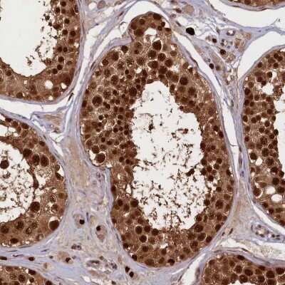 Immunohistochemistry-Paraffin: APPBP1 Antibody [NBP1-92162]