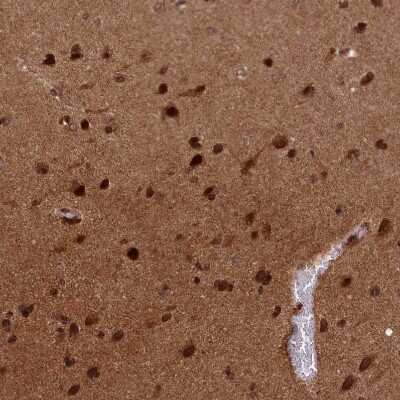 Immunohistochemistry-Paraffin: APPBP1 Antibody [NBP1-92163]