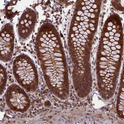 Immunohistochemistry-Paraffin: APPBP1 Antibody [NBP1-92163]
