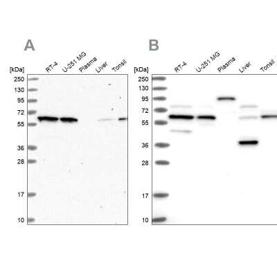 Western Blot: APPBP1 Antibody [NBP1-92162]