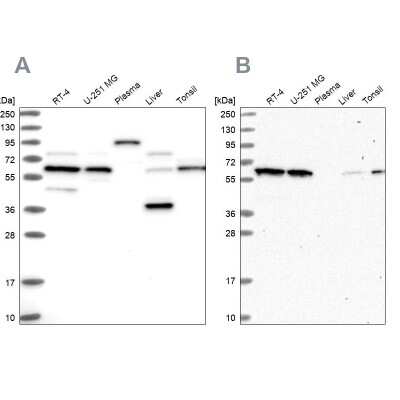 Western Blot: APPBP1 Antibody [NBP1-92163]