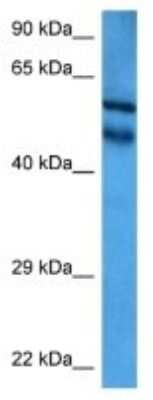 Western Blot: NEDD8 Activating Enzyme (APPBP1/UBA3) Antibody [NBP3-09991]