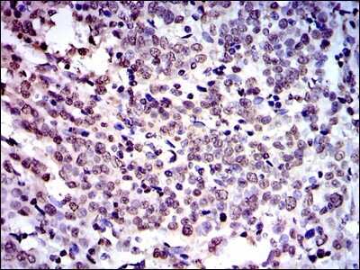 Immunohistochemistry: NEDD8 Antibody (1A7) - BSA Free [NBP2-37524]