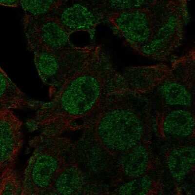 Immunocytochemistry/ Immunofluorescence: NEDD8 Antibody [NBP2-68600]