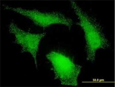 Immunocytochemistry/ Immunofluorescence: NEDD9/CASL/HEF1 Antibody (1B4) [H00004739-M01]
