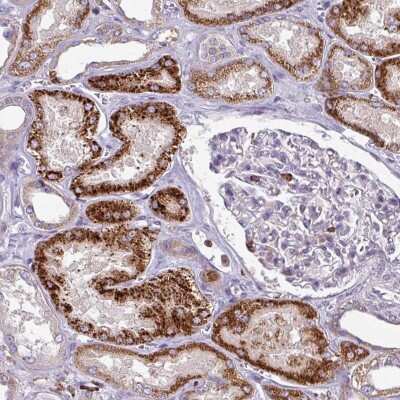 Immunohistochemistry-Paraffin: NEDD9/CASL/HEF1 Antibody [NBP2-37887]