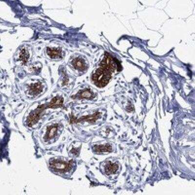 Immunohistochemistry-Paraffin: NEDD9/CASL/HEF1 Antibody [NBP3-17640]