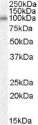 Western Blot: NEDD9/CASL/HEF1 Antibody [NB100-68151]