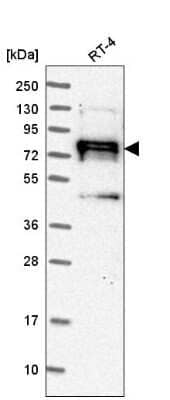 Western Blot: NEDD9/CASL/HEF1 Antibody [NBP2-55071]