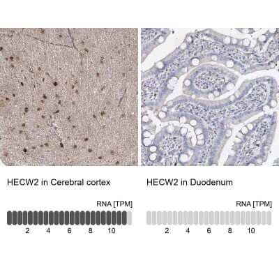 Immunohistochemistry-Paraffin: NEDL2 Antibody [NBP1-92174]