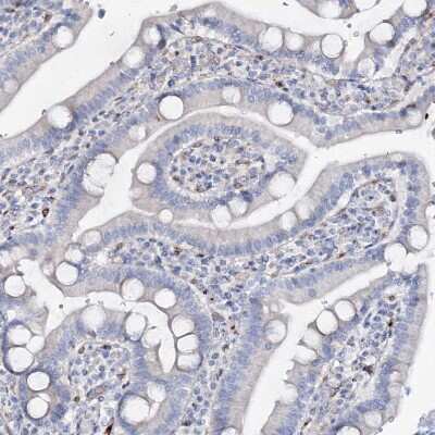 Immunohistochemistry-Paraffin: NEDL2 Antibody [NBP1-92174]
