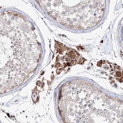 Immunohistochemistry-Paraffin: NEDL2 Antibody [NBP1-92174]