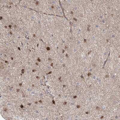 Immunohistochemistry-Paraffin: NEDL2 Antibody [NBP1-92174]