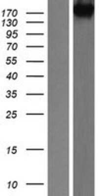 Western Blot: NEDL2 Overexpression Lysate [NBP2-06610]