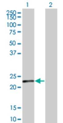 Western Blot: NEDP1/SENP8 Antibody (2E1) [H00123228-M06]