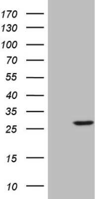 Western Blot: NEDP1/SENP8 Antibody (OTI3E4) [NBP2-45761]