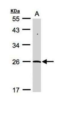 Western Blot: NEDP1/SENP8 Antibody [NBP1-31208]