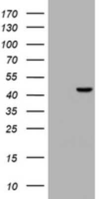 Western Blot: NEIL1 Antibody (OTI1D1) [NBP2-45857]