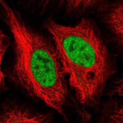 Immunocytochemistry/ Immunofluorescence: NEIL1 Antibody [NBP2-47358]