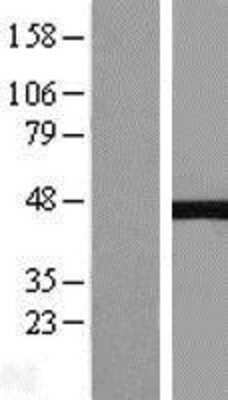 Western Blot: NEIL1 Overexpression Lysate [NBL1-13579]