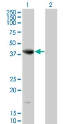 Western Blot: NEIL2 Antibody (1B7) [H00252969-M01]