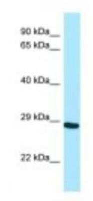 Western Blot: NEIL2 Antibody [NBP1-98526]