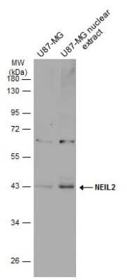 Western Blot: NEIL2 Antibody [NBP3-13112]