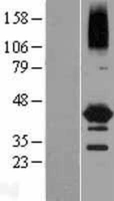 Western Blot: NEIL2 Overexpression Lysate [NBL1-13580]