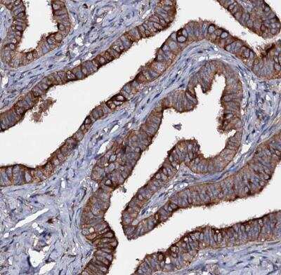 Immunohistochemistry-Paraffin: NEK1 Antibody [NBP1-82883]