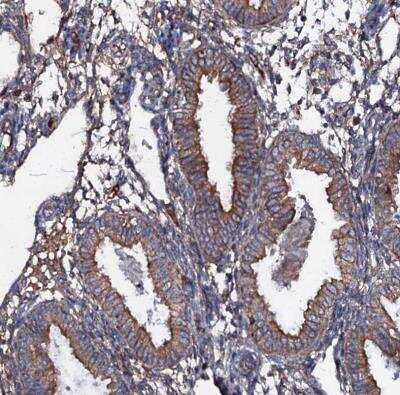 Immunohistochemistry-Paraffin: NEK1 Antibody [NBP1-82883]