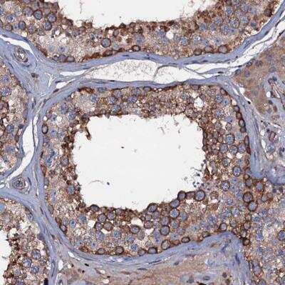 Immunohistochemistry-Paraffin: NEK1 Antibody [NBP1-82883]