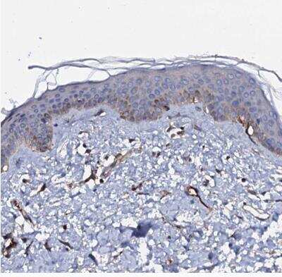 Immunohistochemistry-Paraffin: NEK1 Antibody [NBP1-82883]