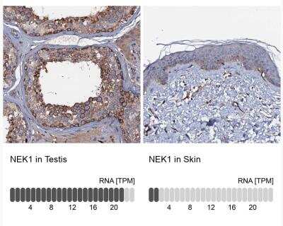 Immunohistochemistry-Paraffin: NEK1 Antibody [NBP1-82883]