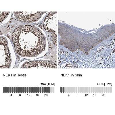 Immunohistochemistry-Paraffin: NEK1 Antibody [NBP1-82884]