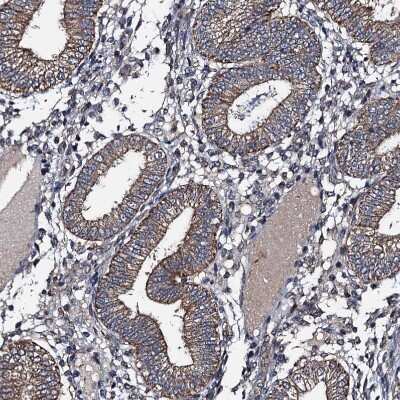 Immunohistochemistry-Paraffin: NEK1 Antibody [NBP1-82884]