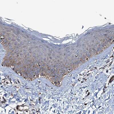 Immunohistochemistry-Paraffin: NEK1 Antibody [NBP1-82884]