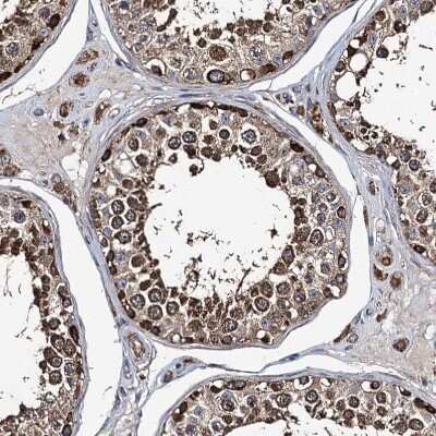Immunohistochemistry-Paraffin: NEK1 Antibody [NBP1-82884]