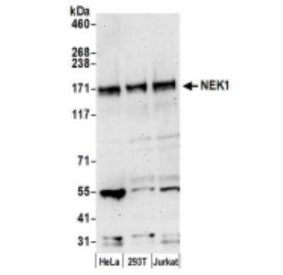 Western Blot: NEK1 Antibody [NBP2-36534]