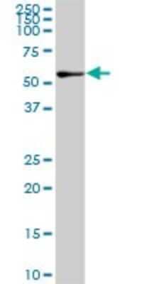 Western Blot: NEK10 Antibody (1C9) [H00152110-M01]