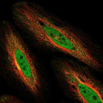 Immunocytochemistry/ Immunofluorescence: NEK10 Antibody [NBP1-81991]