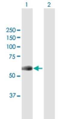 Western Blot: NEK10 Antibody [H00152110-B01P]