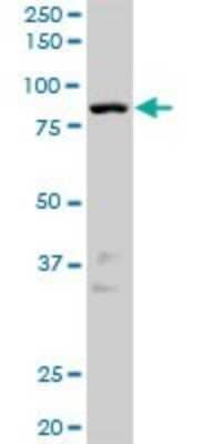 Western Blot: NEK10 Antibody [H00152110-D01P]