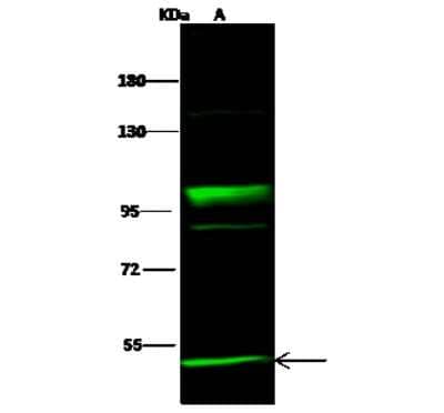 Western Blot: NEK10 Antibody [NBP2-99009]