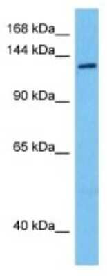 Western Blot: NEK10 Antibody [NBP3-10139]