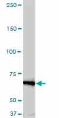 Western Blot: NEK11 Antibody (4E1-1F4) [H00079858-M01]