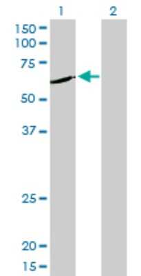 Western Blot: NEK11 Antibody (4E1-1F4) [H00079858-M01]