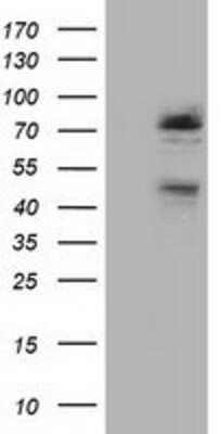 Western Blot: NEK11 Antibody (OTI4H5) [NBP2-02911]