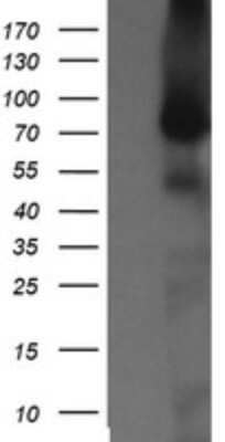 Western Blot: NEK11 Antibody (OTI5D9)Azide and BSA Free [NBP2-72935]